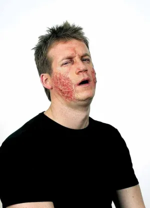 Don Post Scorched Skin Costume Makeup